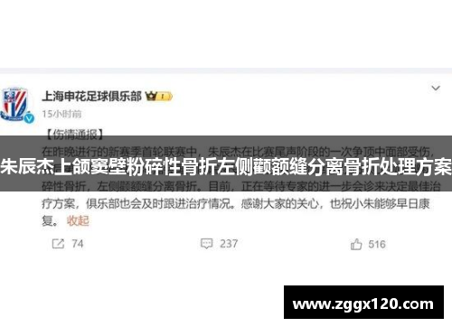 朱辰杰上颌窦壁粉碎性骨折左侧颧额缝分离骨折处理方案